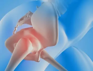 Anterior Hip Replacement: A Minimally Invasive Option for Faster Recovery