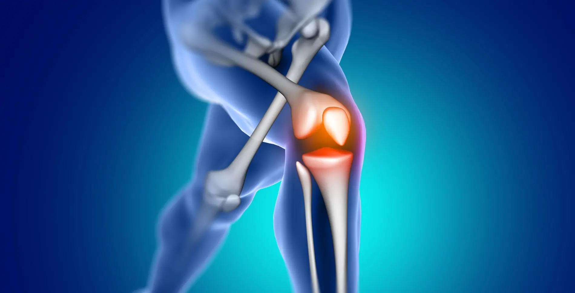 Navigating Risks, potential Complications, and Preventative Measures Following Knee Replacement Surgery